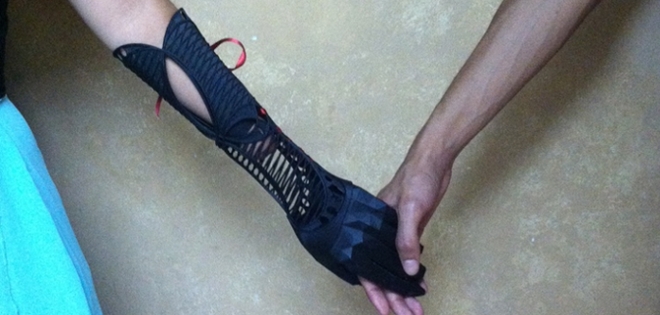 Joven creó elegante prótesis para su compañera de clase