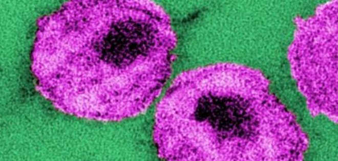 Bebé nacida con VIH queda libre del virus tras tratamiento temprano