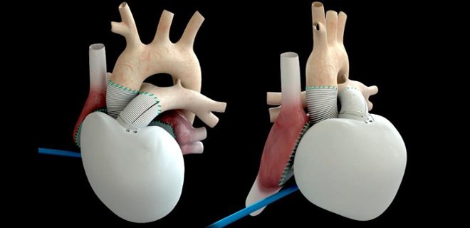 Trasplantan por primera vez un corazón artificial con tejidos biológicos