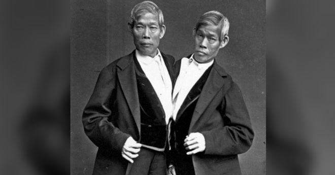 Chang y Eng Bunker, los siameses que tuvieron 21 hijos