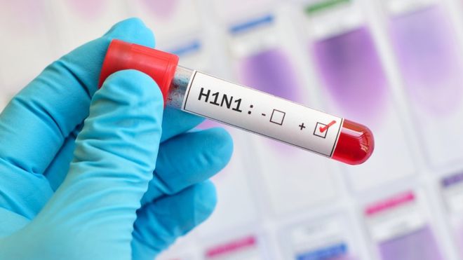 Por qué la gripe A-H1N1 no paró la economía mundial