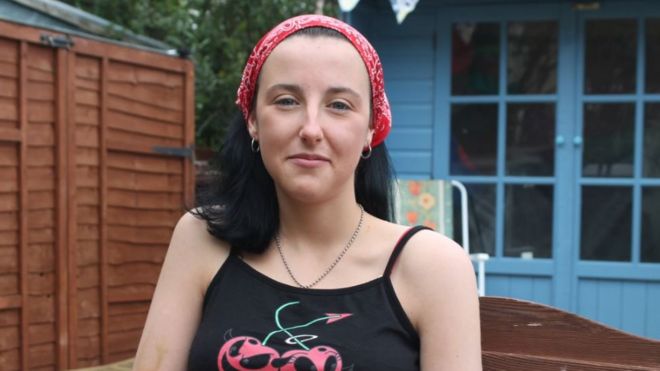 La joven que se ha sometido a 66 cirugías por una enfermedad que nadie conoce