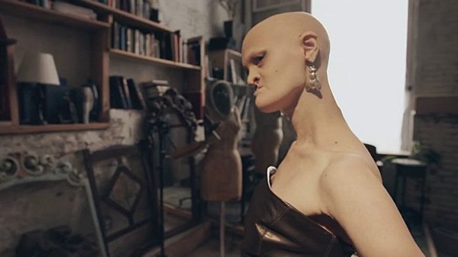 La modelo internacional con una mutación genética única que la dejó calva y sin dientes