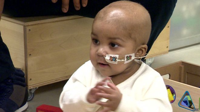 Tratamiento pionero con células de diseño revierte leucemia en una niña de 1 año