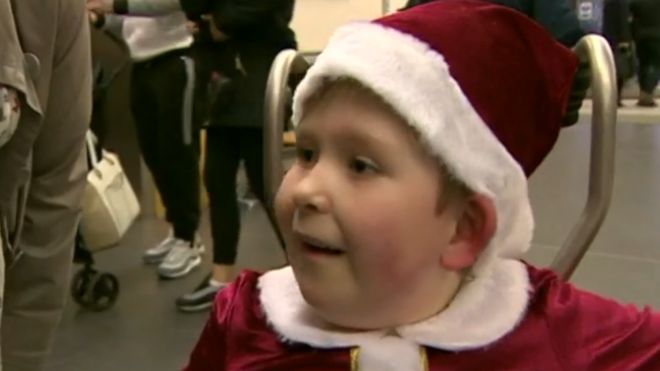 El asombroso caso del niño inglés que nació con solo un 2% del cerebro