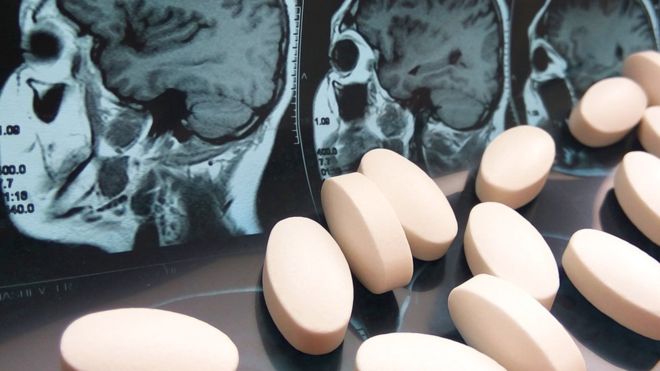 El inesperado y desconocido efecto del paracetamol sobre nuestra personalidad