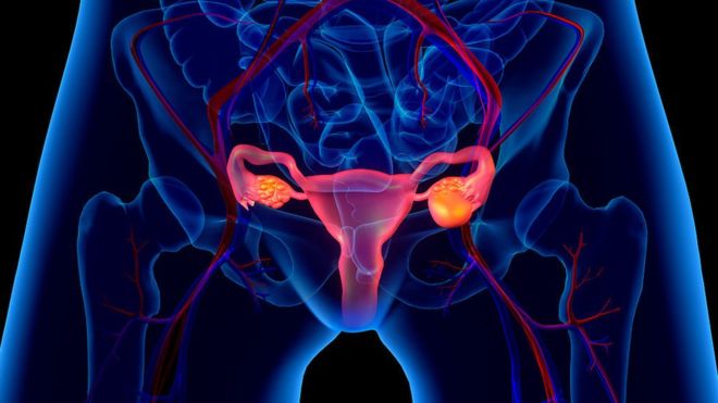 ¿Cómo se forma, qué consecuencias tiene y cómo tratar el ovario poliquístico?