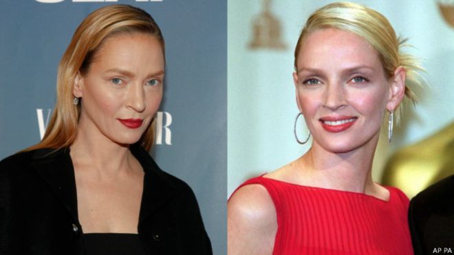 Dismorfofobia, ¿el trastorno tras el cambio de imagen de Uma Thurman?