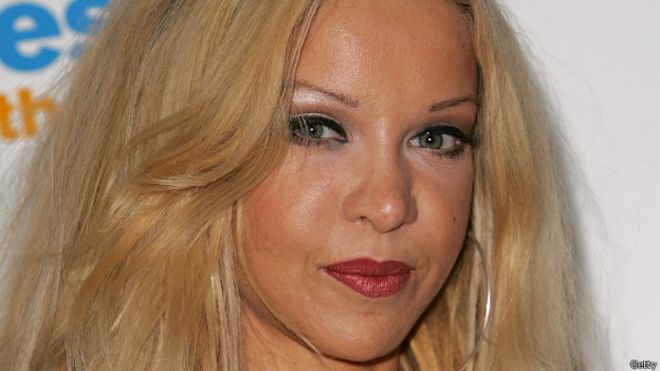 La pesadilla de vivir obsesionado con la propia apariencia