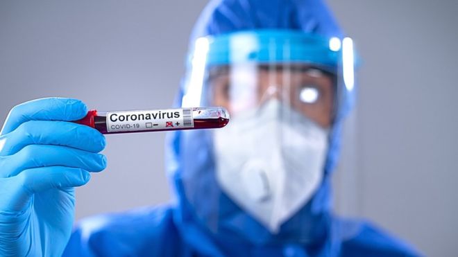 Israel probará su vacuna ante el COVID-19 en humanos