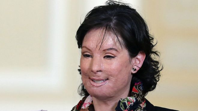 Natalia Ponce de León: la mujer que se convirtió en el rostro de la tragedia de los ataques con ácido en Colombia