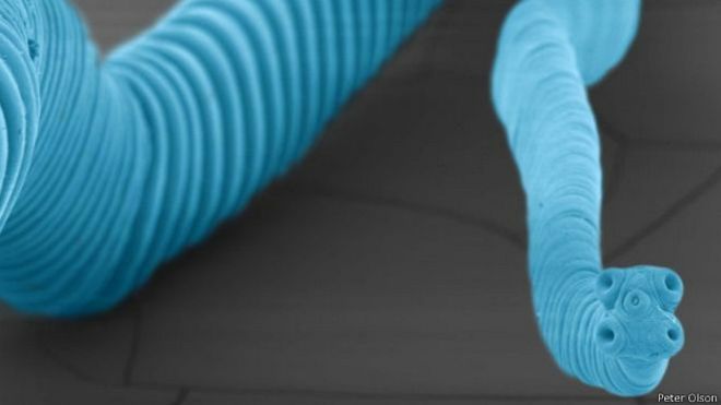 El increíble caso del colombiano que murió de un cáncer "no humano"