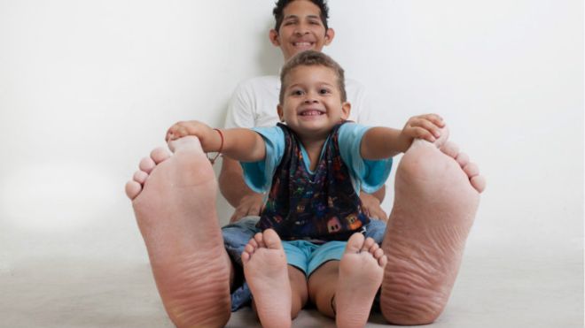 El venezolano que tiene el pie más grande del mundo