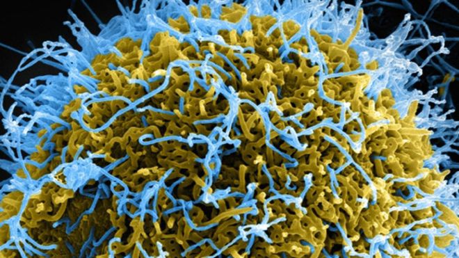 Los sorprendentes beneficios de las infecciones de transmisión sexual