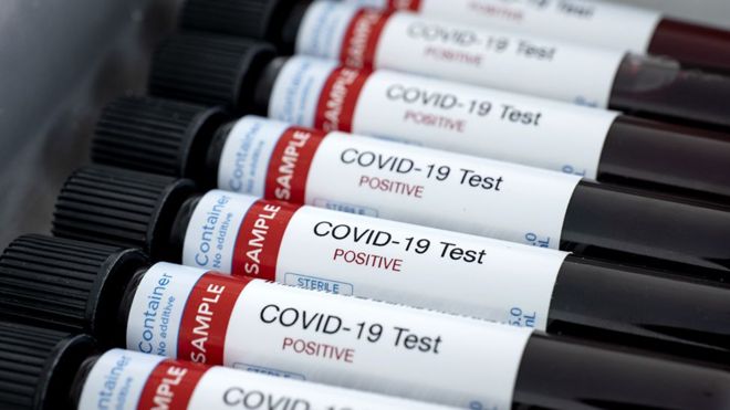 La nueva prueba de anticuerpos que es &quot;crucial&quot; para combatir el COVID-19