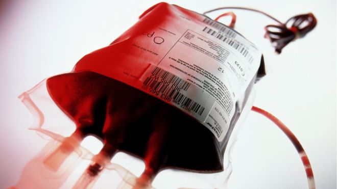 Las polémicas transfusiones de sangre joven para frenar el envejecimiento