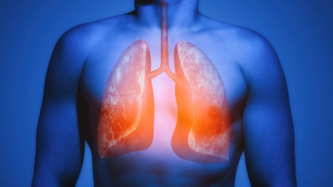 La habilidad de los pulmones para repararse después de fumar