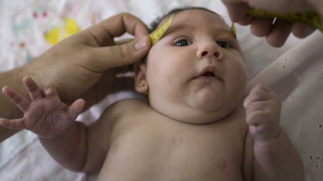 Cómo el virus zika se volvió tan peligroso cuando llegó a América Latina