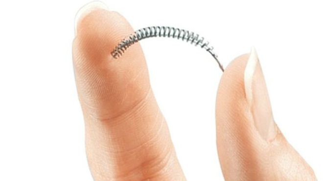 Essure: los riesgos del implante anticonceptivo &quot;más seguro del mundo&quot;