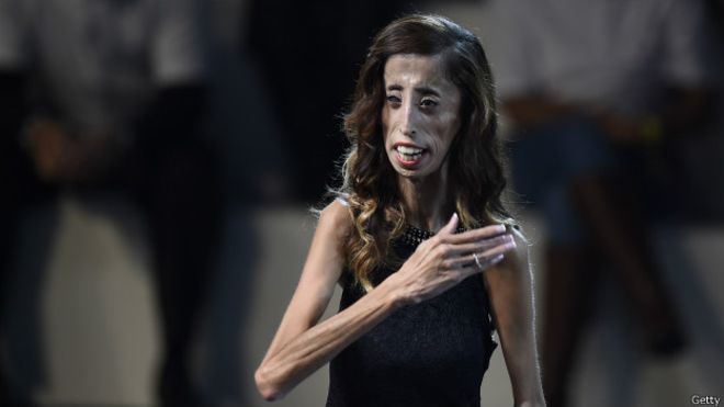 La inspiradora historia de superación de Lizzie Velásquez, &quot;la mujer más fea del mundo&quot;