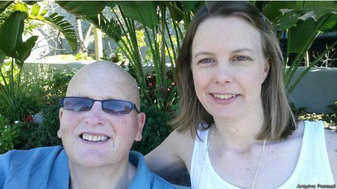 El ex hombre más gordo del mundo que se quitó 25 kilos de piel para caminar mejor