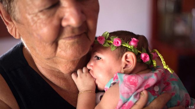 Más allá de rumores y teorías de la conspiración: lo último que se sabe sobre el vínculo entre zika y microcefalia