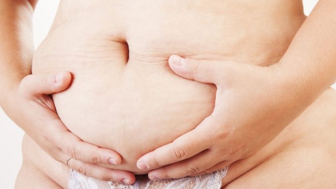 Qué causa la &quot;barriga de mamá&quot; de la que muchas mujeres no consiguen deshacerse y cómo se puede combatir