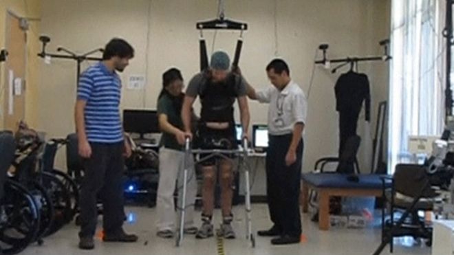 El parapléjico que logró caminar con un lector cerebral y electrodos en las rodillas