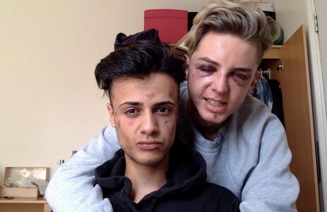 El dramático relato de parejas gay que fueron brutalmente atacadas