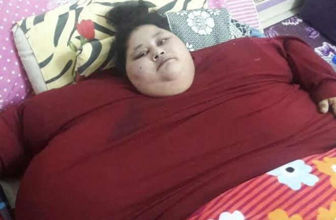 Conozca la última esperanza de Eman, la mujer más obesa del mundo