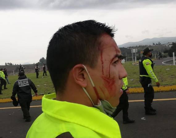 Policías heridos el martes 26 de octubre en varias zonas del país. Foto: Ministerio de Defensa.