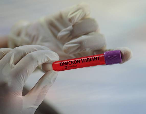 Con ómicron BA-2 en algunos casos no se detectan mediante pruebas de laboratorio. Foto: Pixabay