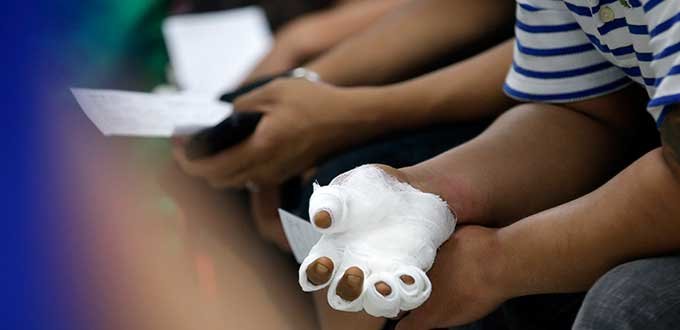 En Ecuador existen 40 niños internados a causa de la pirotecnia manipulada artesanalmente