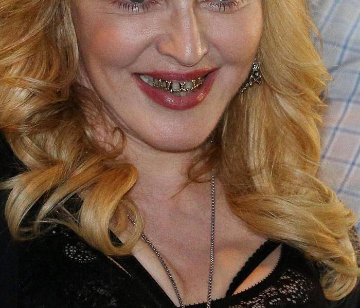 Madonna muestra sus dientes bañados en oro y diamantes