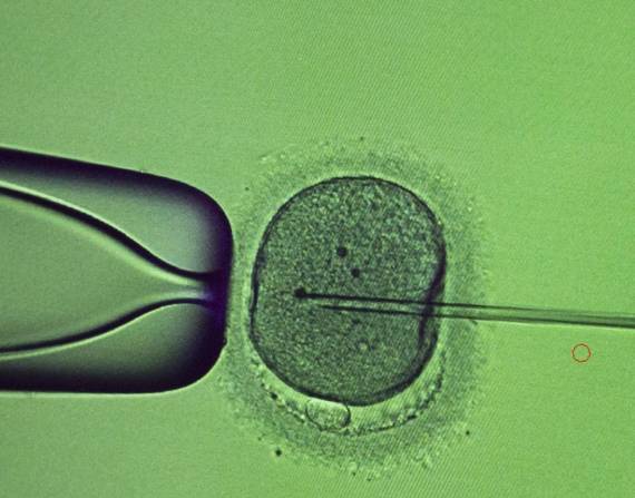 Un especialista efectúa un procedimiento de inyección intracitoplásmica de espermatozoides en el laboratorio de la clínica de fertilidad IVMED en Kiev, Ucrania, el martes 31 de enero de 2023. (AP Foto/Roman Hrytsyna)