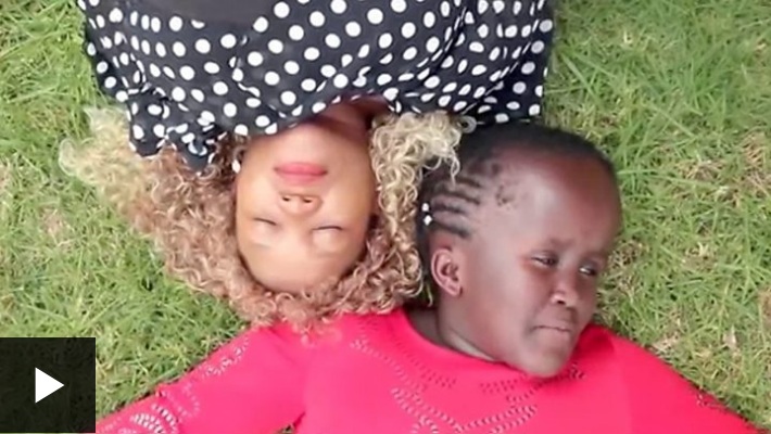 La niña con hidrocefalia que superó el bullying y empezó una carrera musical