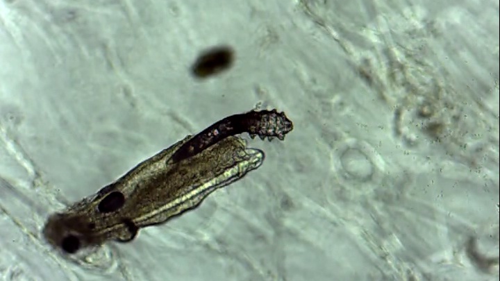 (VIDEO) Así son los ácaros que habitan en nuestro rostro