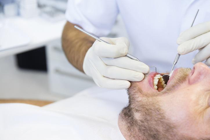 La bacterias bucales son la principal causa de periodontitis