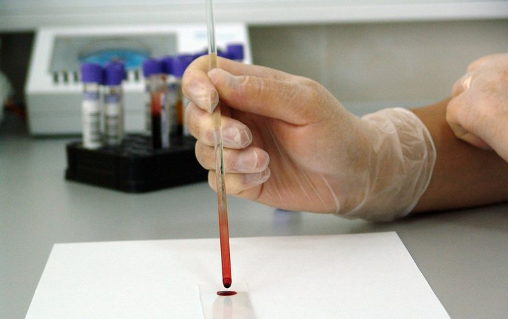 Laboratorio en EEUU identifica nueva cepa del VIH