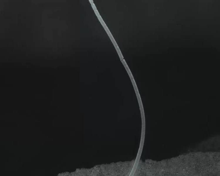 La impresionante imagen de la bacteria más grande del mundo recién descubierta