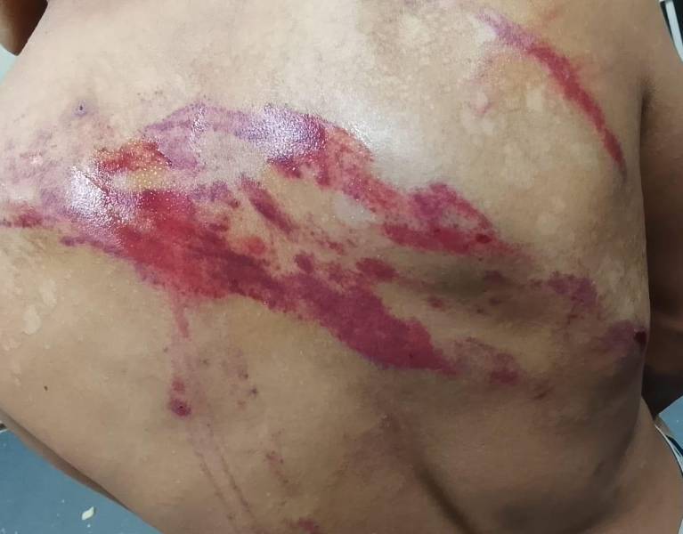 Según los familiares, las marcas en la espalda de este preso habrían sido provocadas por los militares durante operativos en la Penitenciaría del Litoral.