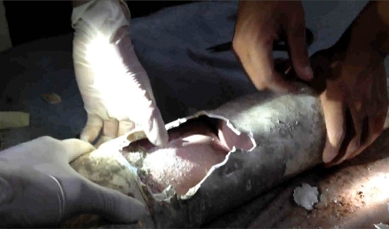 Rescatan a recién nacido atorado en una tubería