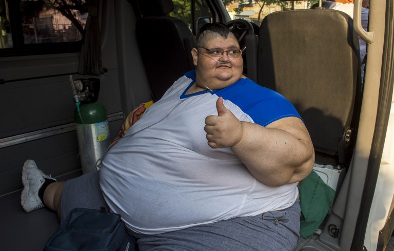 México: hombre más obeso del mundo, sometido con éxito a reducción de estómago