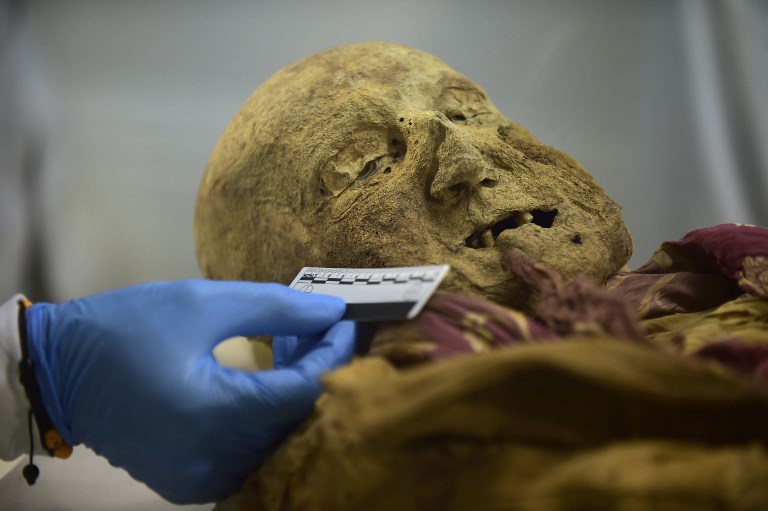 Momia de Guano, el eslabón perdido de una rara enfermedad en Europa