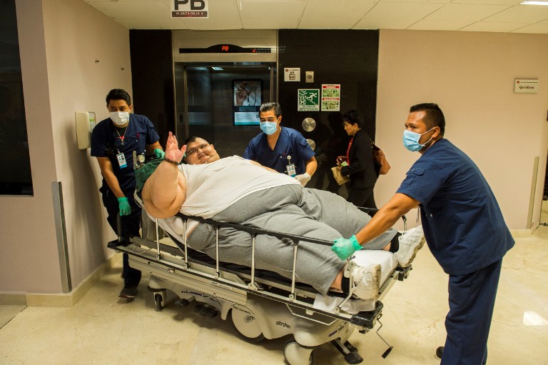 El hombre más obeso del mundo está listo para cirugía en México