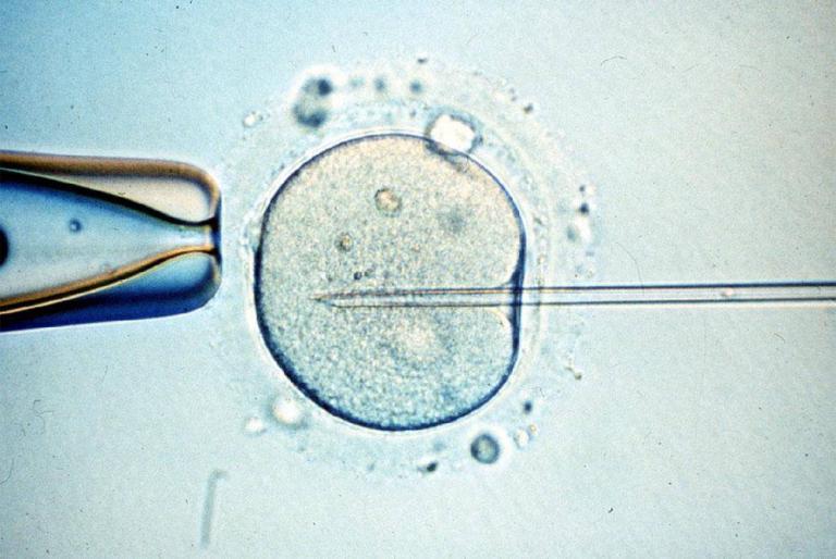 Imagen referencial a la fecundación in vitro.