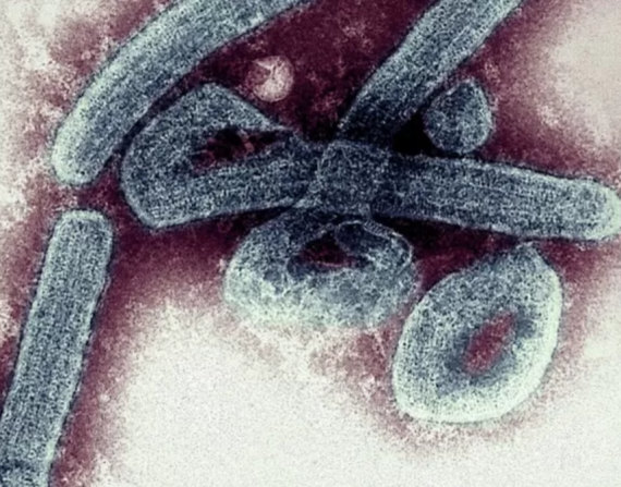 El virus de Marburgo se detectó por primera vez en la ciudad de Marburgo, en Alemania, en 1967.