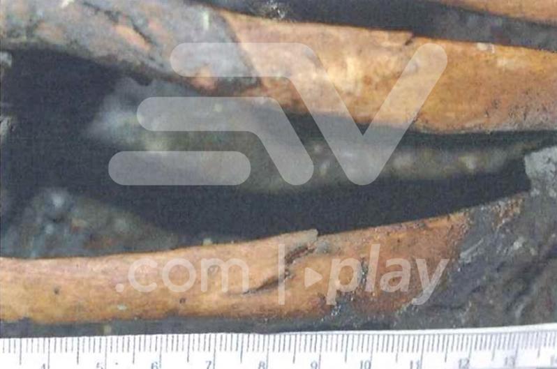 El análisis forense detectó fracturas, golpes y heridas correspondientes a disparos.