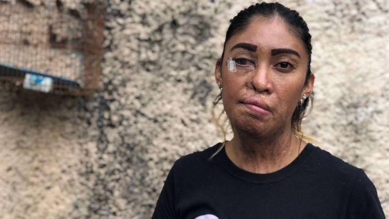 Me decía que si yo no era suya, no iba a ser de nadie. Lo dejé y me atacó