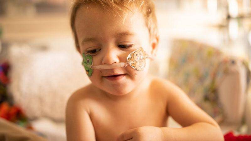 El poco conocido virus que aumentó en niños durante la pandemia de coronavirus